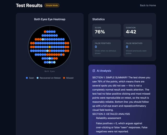 Primetry Online Visual Field Test (Home Perimetry)